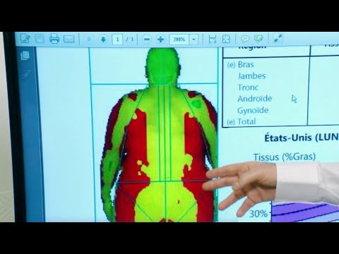 Vidéo: Types De Graisse Corporelle: Avantages, Risques, Régime Alimentaire, Pourcentage De Graisse Corporelle Et Plus