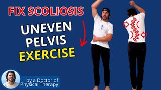 Exercise for Scoliosis Relief | Pelvic Side Tilt Correction
