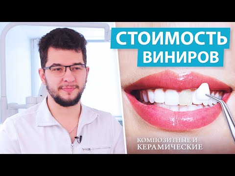 Виниры - виды, цена, установка виниров для зубов