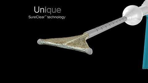 NovaSure V5 Endometrial Ablation Reveal