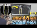 #인공관절 수술_82세 관절염 4기환자 생생한 과정 3화 수술후상태