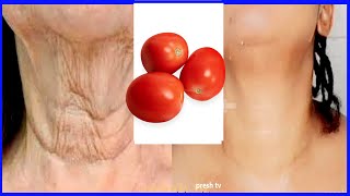 Tomato in 5 days remove neck wrinkles at home completely / in 5 days tomato remedy for neck lines