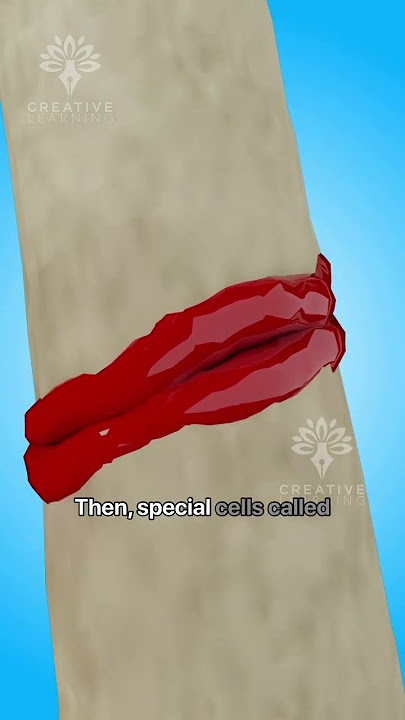 How Fast Can Your Body Heal a Broken Bone 😮 #shorts #bonefracture - Creativelearning3d