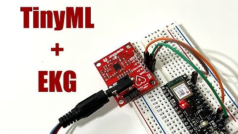 TinyML Tutorial: Detecting Arrhythmias with AD8232 and TensorFlow Lite on Arduino Nano 33 BLE
