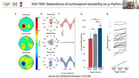 Neuromodulation WFNR Silver Jubilee Webinar