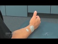 Electrode placement for thumb extension