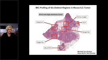 Comprehensively characterize the tissue microenvironment at single cell resolution with IMC Nov25 1