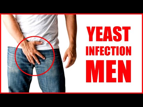 Video: Thrush In Men - Symptoms, Treatment, Causes, Signs
