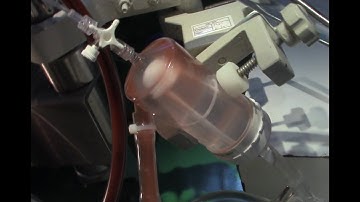 Bubble Trap in Cardiopulmonary Bypass Circuit. Shorts