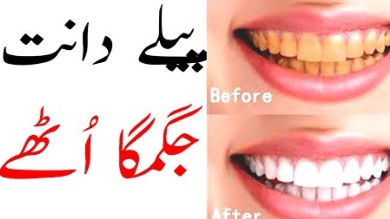 how to whiten teeth with lemon how to whiten teeth at home in one dayhealth sehat YouTube