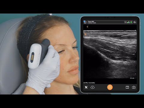 Pocus Foot Injection Ultrasound Guided Temple Injection Right Side – PoCUS FOAMED