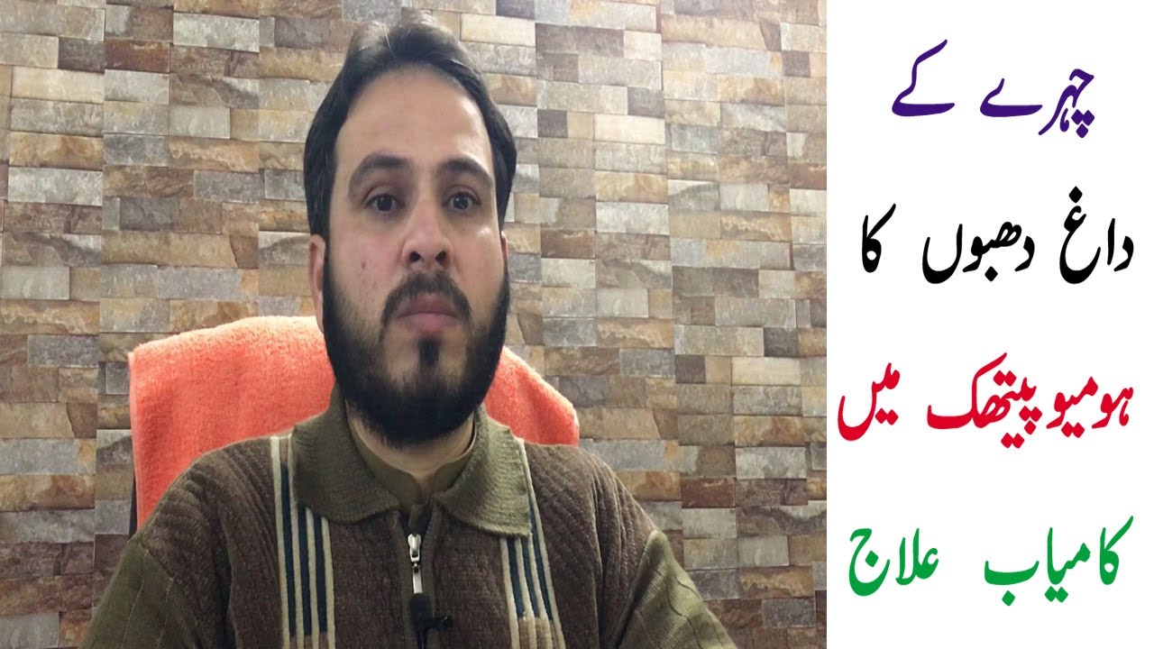 Melasma tratment ! Melasma homeopathic Treatment ! hyperpigmentation