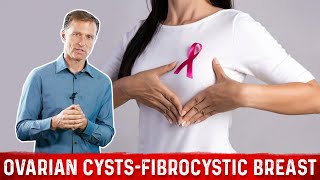 How to Remove Ovarian Cysts & Treat Fibrocystic Breast with this ONE Mineral! – Dr.Berg