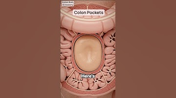 What Diverticula Look Like Inside Your Colon | 3D Gut Health Animation