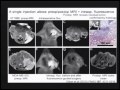 Dr. Roger Tsien: Improving Surgery Through Target Specific Molecular Imaging
