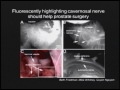 Dr. Roger Tsien: Improving Surgery Through Target Specific Molecular Imaging