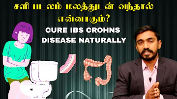 மலத்தில் சளி வெளியேறினால் என்ன நோய் ? என்ன சிகிச்சை எடுக்கவேண்டும் ? | MUCUS IN STOOL | DrSJ #IBS