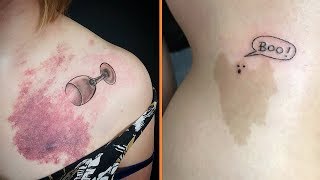 Ugly Scars and Birthmarks Covered Up By Tattoos And They Looks Amazing by Tooco 35,417 views 5 years ago 4 minutes, 11 seconds