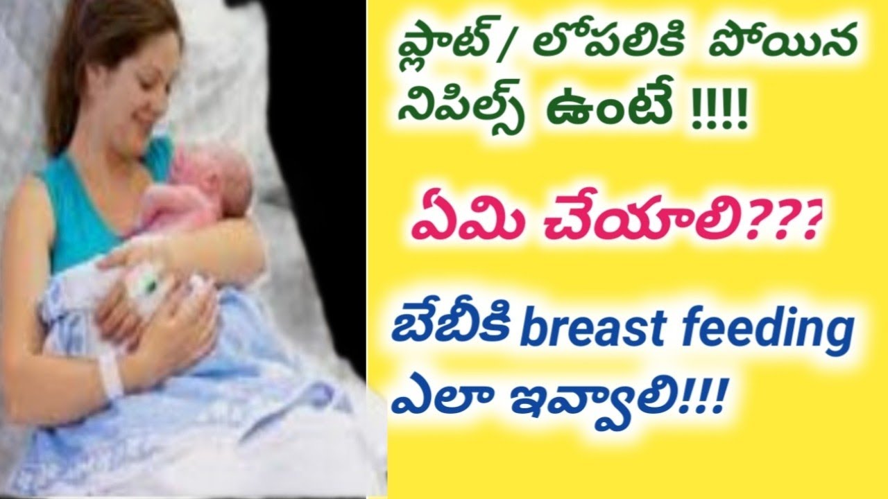 Breast feeding problems/after delivery feeding techniques