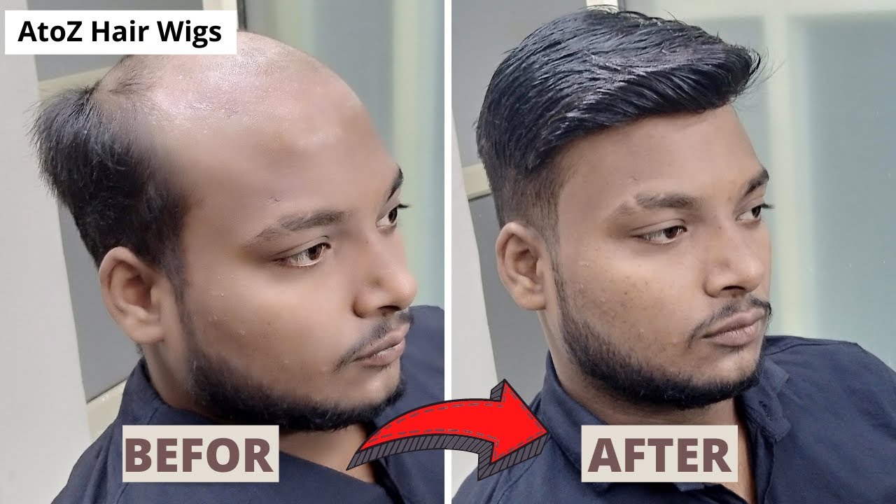 Hair Wigs In Gurgaon Gurugram 9643814000 Hair Wig Shop Wholesale