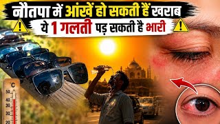 Nautapa 2026: Heatwave में Cheap Sunglasses बन सकते हैं खतरा | Doctors Warning | Eye Care Tips