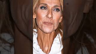 Isolada Em Mansão, Sem Se Mexer A Luta De Céline Dion Contra Doença Rara