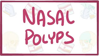 Nasal Polyps - causes, symptoms, diagnosis, treatment, pathology