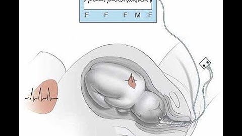 #finalyearprojects 2021 | Smart Cardiotocography Fetal Monitoring System based on Phonocardiogram