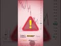 I Checked Every Bullish, Bearish, and Neutral Signal | AI Market Analysis #trading #tradingstrategy