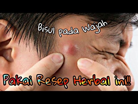 Cara Mengatasi Bisul pd Bagian Wajah 
