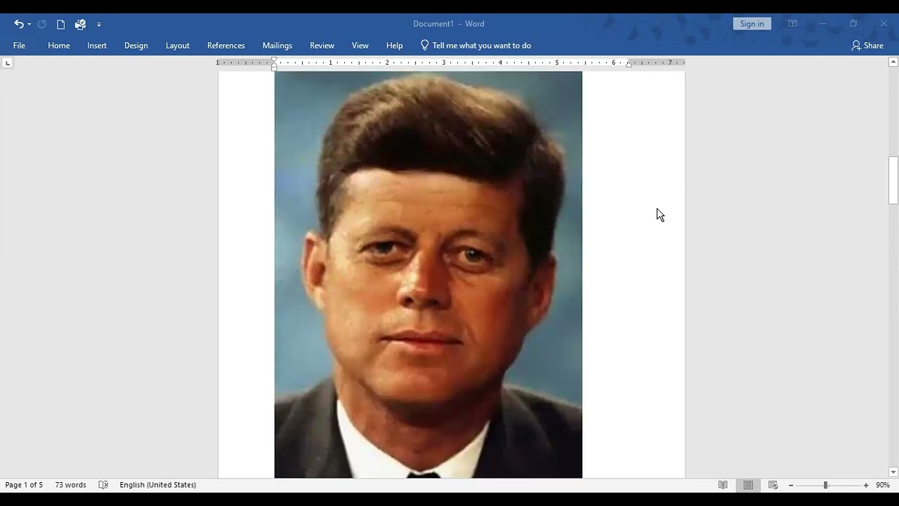 MRCP PACES Station 5 addison, ankylosing spondylitid