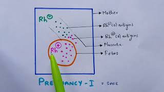 Erythroblastosis fetalis | Hemolytic anemia | Rh incompatibility | Symptoms | Bio science