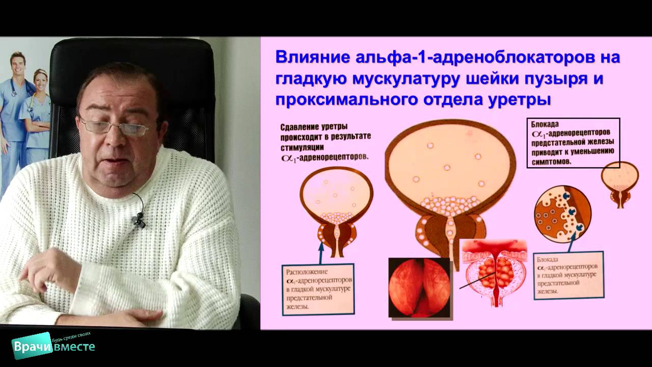 Современный подход к выбору альфа-адреноблокатора