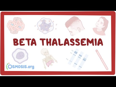 Beta-thalassemia - causes,