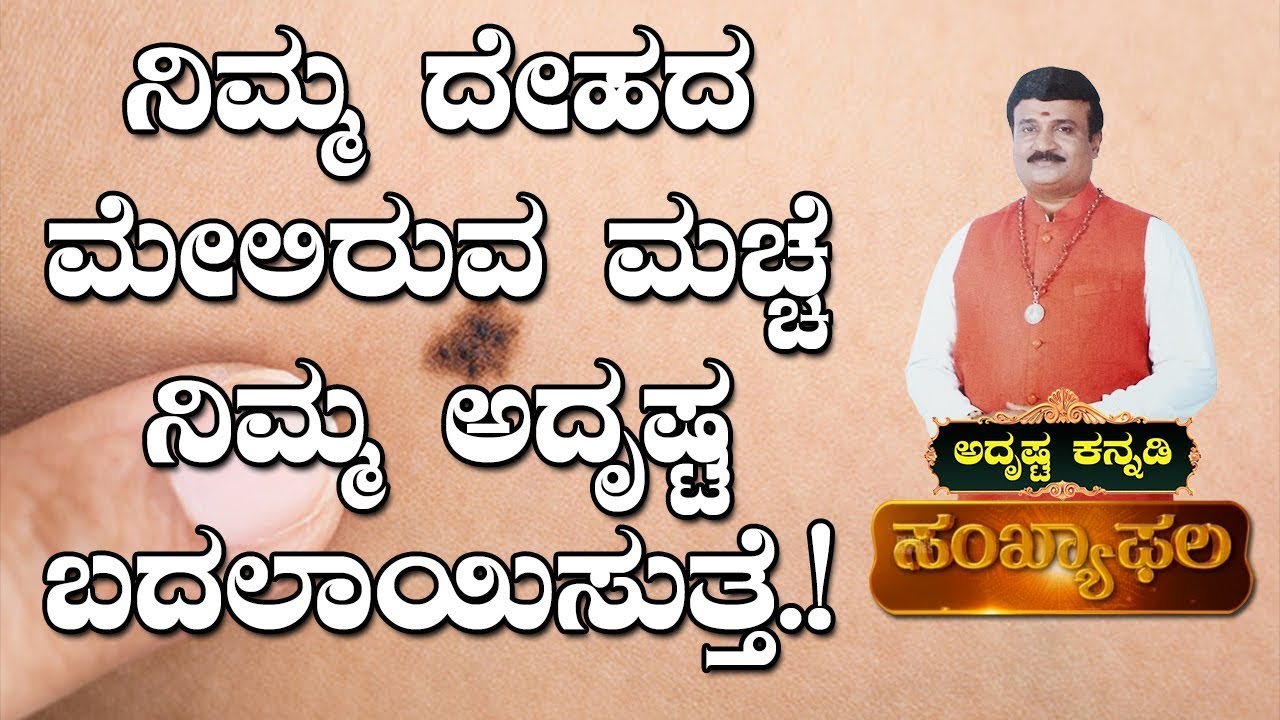 What Does Your Mole on Body Say About You? : AdithyaNarayan Guruji - Adrustaa Kannadi