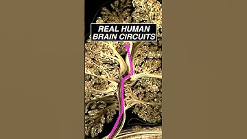 Human #brain circuits seen using diffusion spectral imaging data #neuroscience #science #anatomy