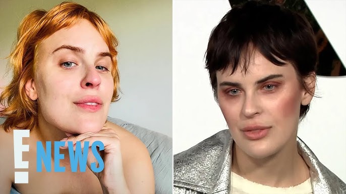 Tallulah Willis Candidly Reveals Why She Dissolved Her Facial Fillers