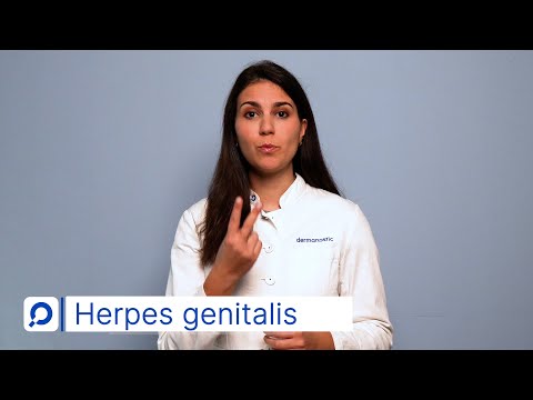 Video: Ist Herpes lebenslang?