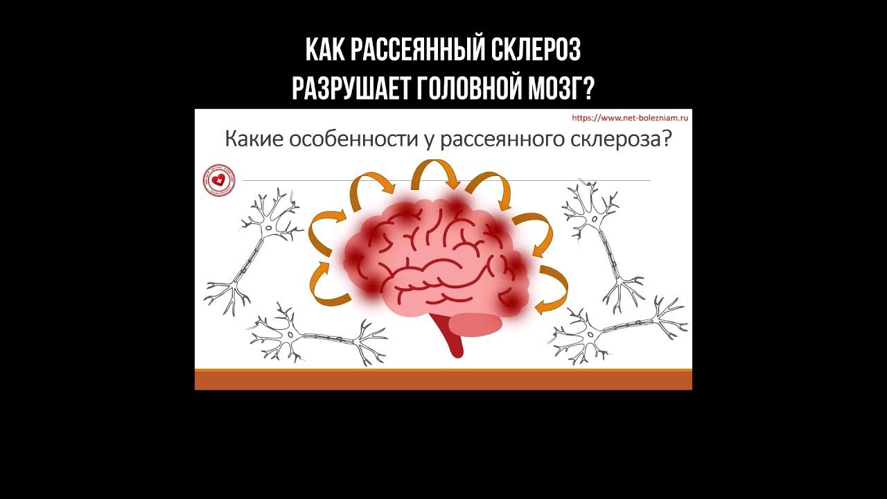 Разрушили голову. Склероз мозга симптомы. Мозг с склерозом рисунок. Как рассеивается ум.