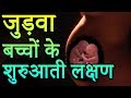 Pregnant With Twins - Pregnancy में जुड़वा बच्चों के शुरुआती लक्षण | Pregnancy Gyan