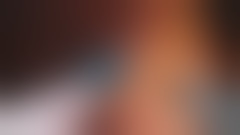 daVinci Xi Right Robotic Partial Nephrectomy - Unedited