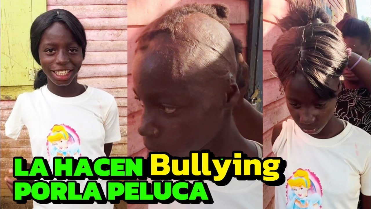 LA RELAJAN POR LLEVAR PELUCA A SU ESCUELA LUEGO DE HABER SUFRIDO UNA DESCARGA ELECTRÓNICA