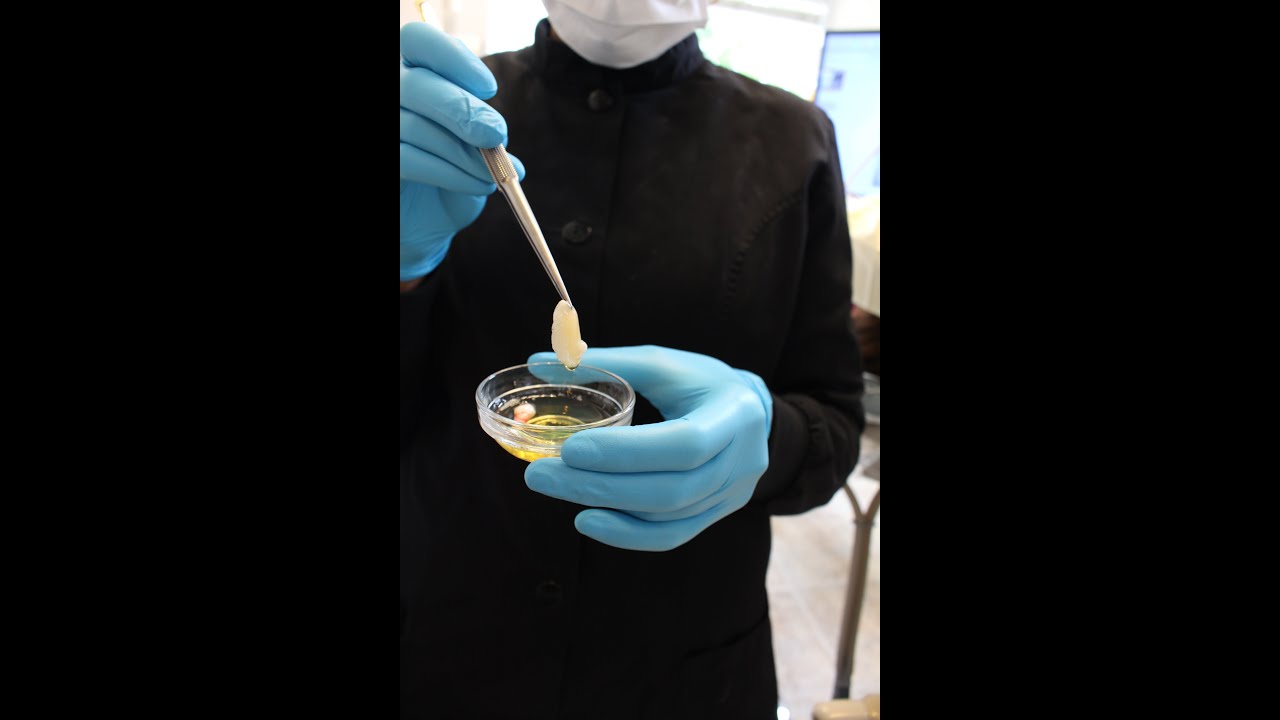 Modern Dentistry is Holistic Dentistry- Stem Cell Therapy
