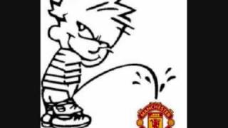 Manchester United Suck