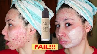 BURTS BEES FOUNDATION for ACNE?!?! | FAIL First Impression