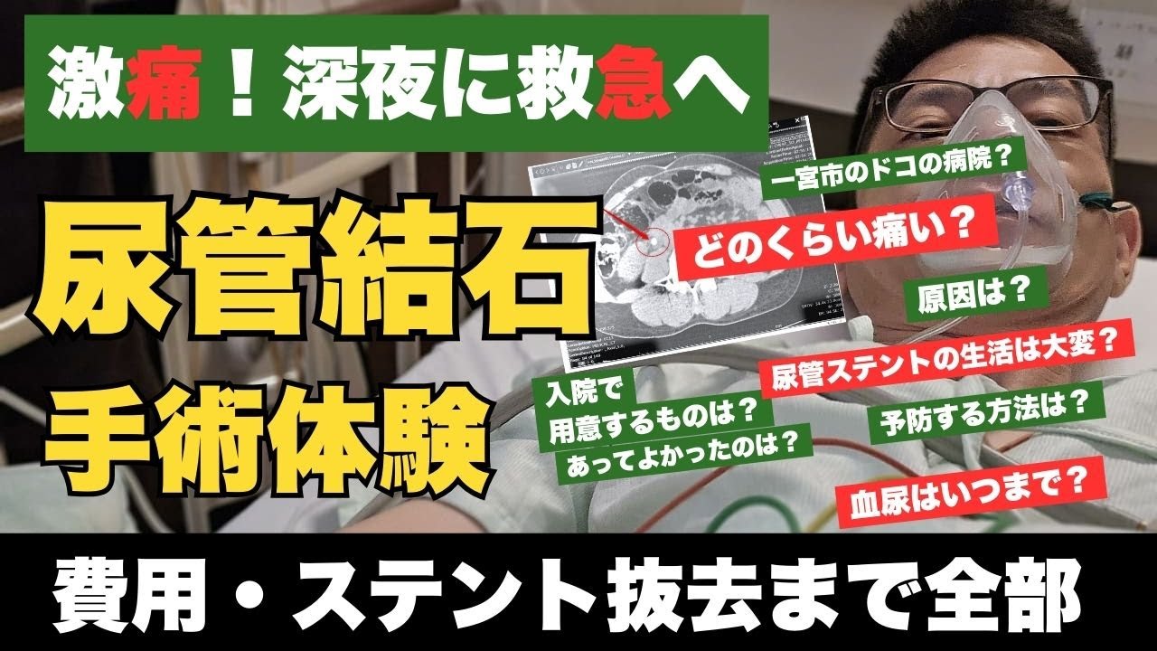 尿管結石 激痛から手術、そしてステント地獄｜完全記録