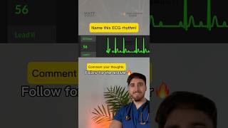 Name this ECG rhythm Guess the diagnosis medical diagnosis