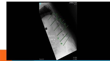 Secret #9 - Analysis of Motion Segment Integrity www.ezqmeceu.com QME Continuing Education