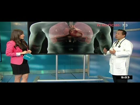 Vídeo: ¿Qué Le Sucede A La Presión Arterial Durante Un Ataque Al Corazón?