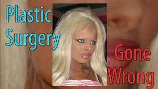 Plastic Surgery Gone Wrong - PSC Uncut - Ep.10